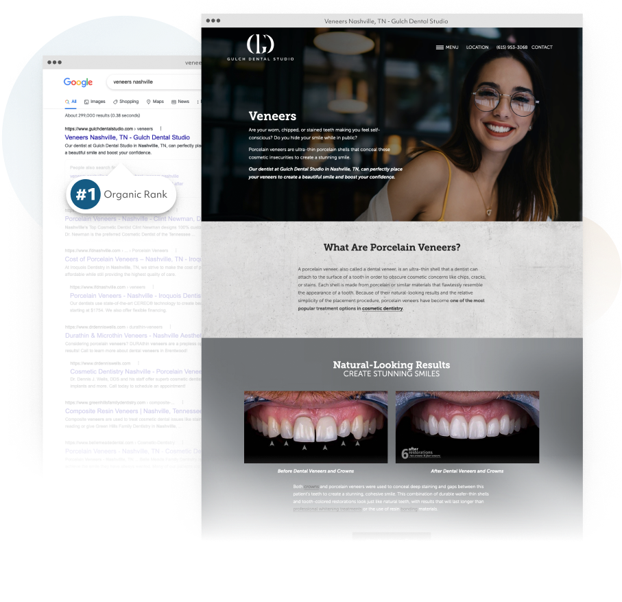 premium SEO page and SERPs