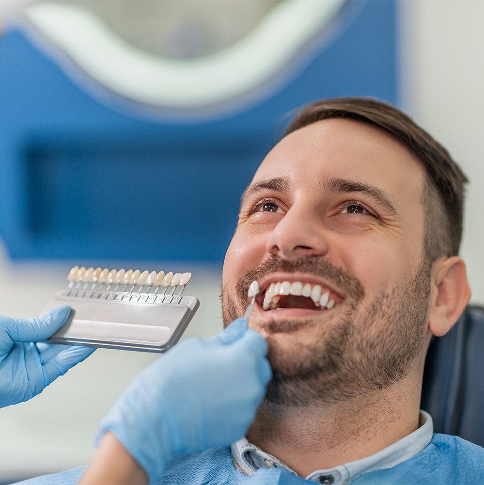 Man getting shade-matched for veneers