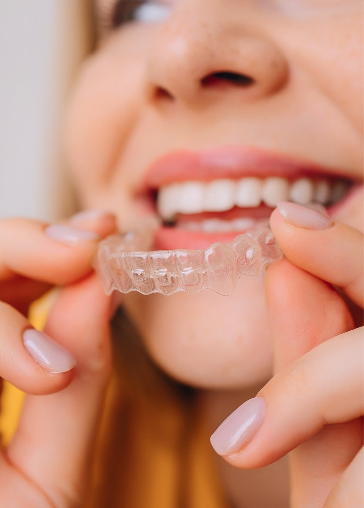 smiling woman about to wear SureSmile® clear aligner