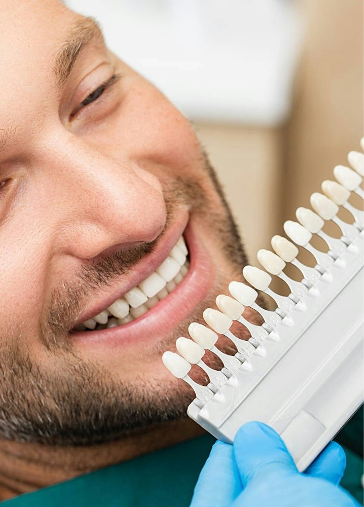 man comparing dental crown veneer shades