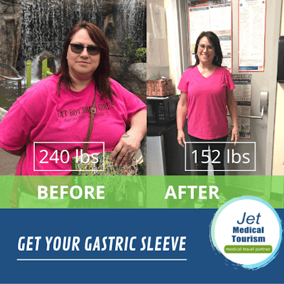 Gastric Sleeve Before and After Pictures: Best VSG Photos (2022)