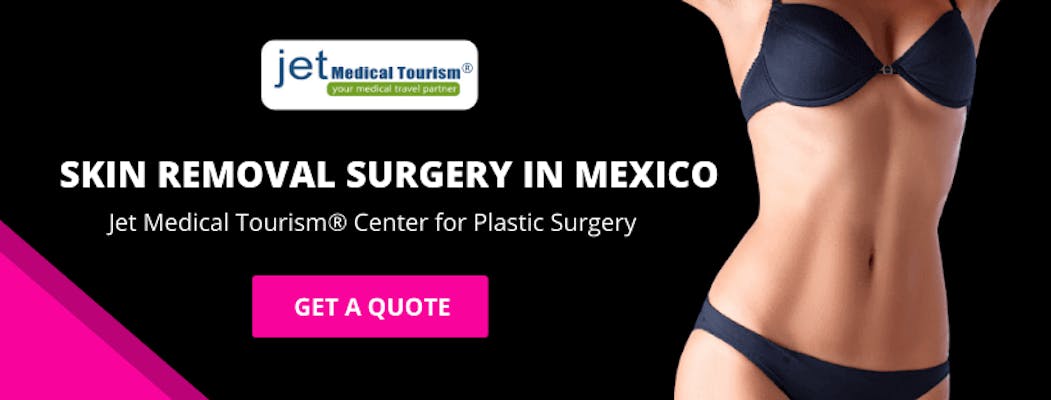 Skin Removal Surgery In Mexico