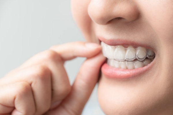 adult wearing invisalign