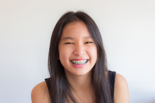 teenage girl in braces