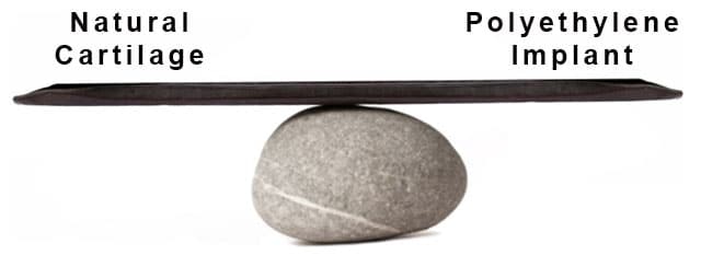 A comparison of rib cartilage versus polyethylene medpor or supor