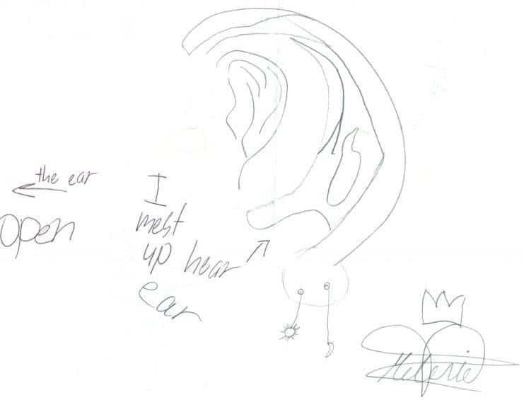 dr bonilla microtia patient letter 75