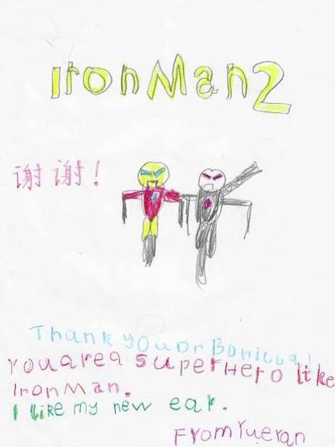 Dr Bonilla Microtia Patient 213