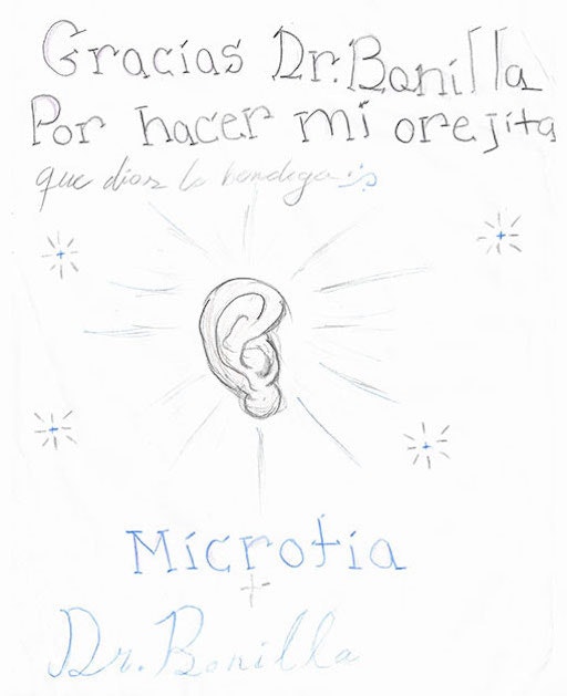 Dr Bonilla Microtia Patient 204