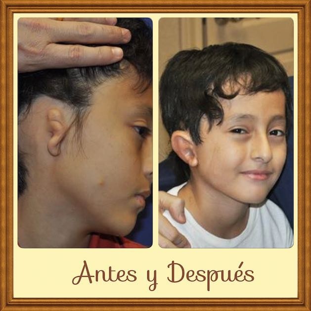 dr bonilla microtia patient letter 82