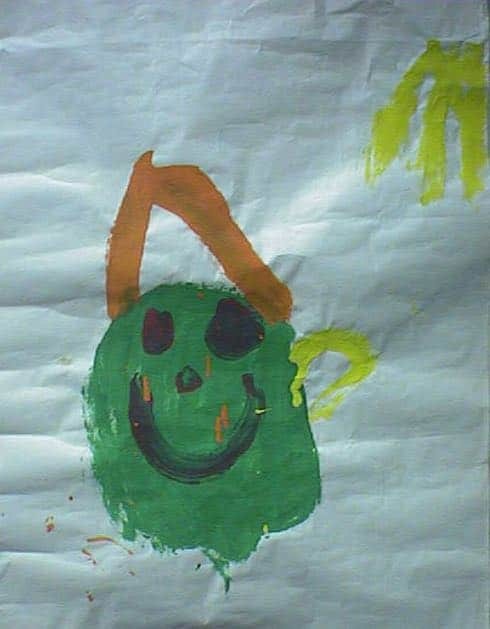 microtia-reconstruction-patient-letters