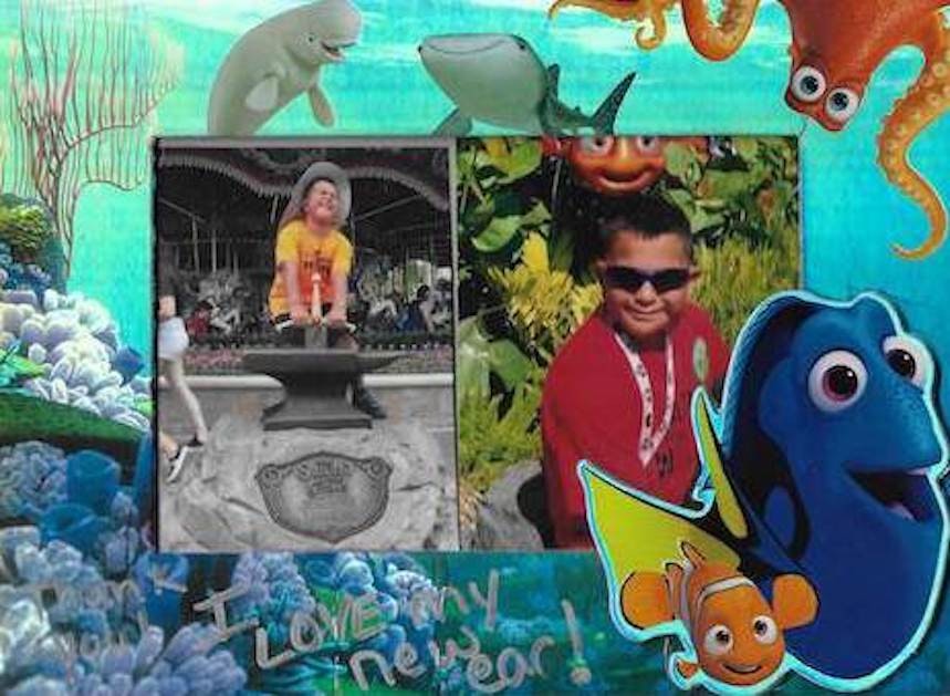 Dr Bonilla Microtia Patient 210