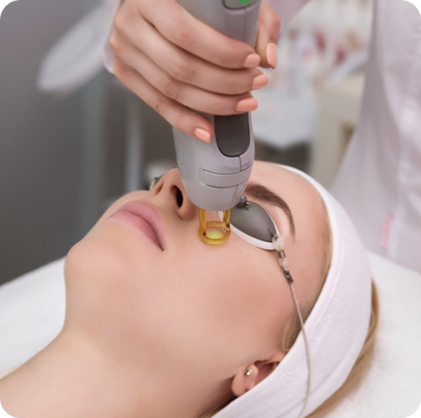 Woman receiving IPL therapy