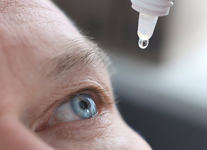 Eye drops into dry eyes