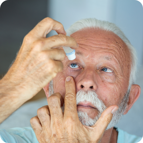 Many with dry eyes using eye drops