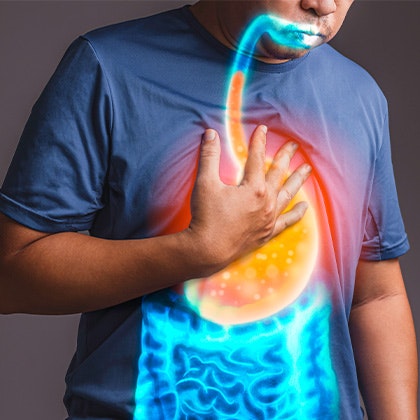 Man with gastro reflux