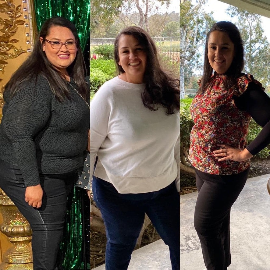 Before Photo Placeholder