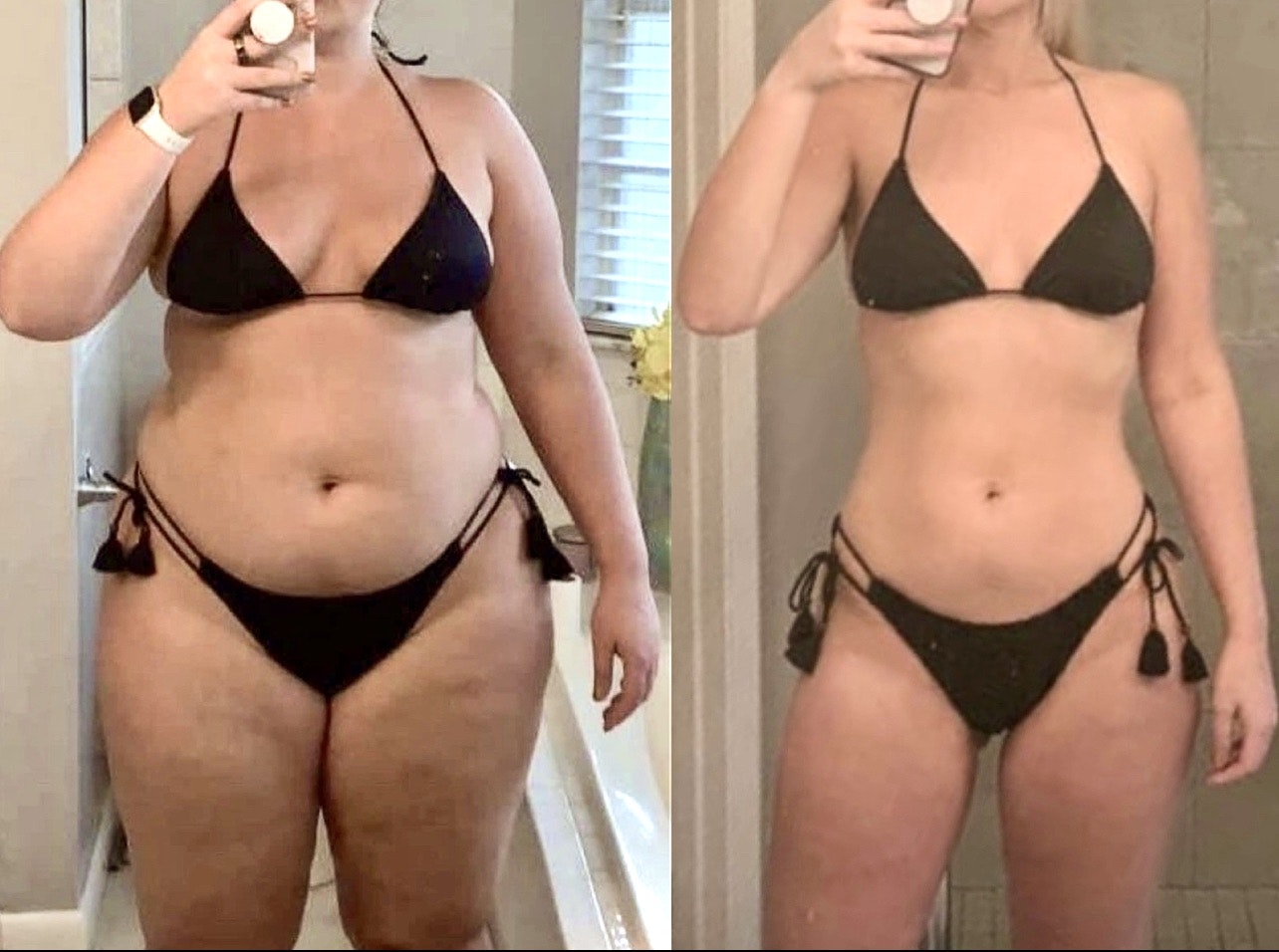 Woman with no scars on abdomen