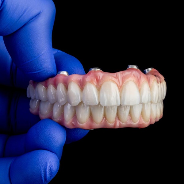 All-on-4 dentures