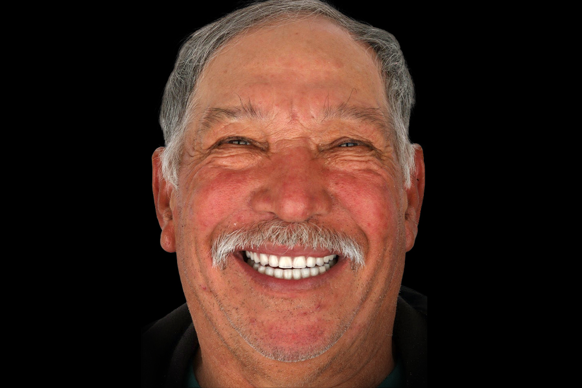 the same man with a bright and complete smile