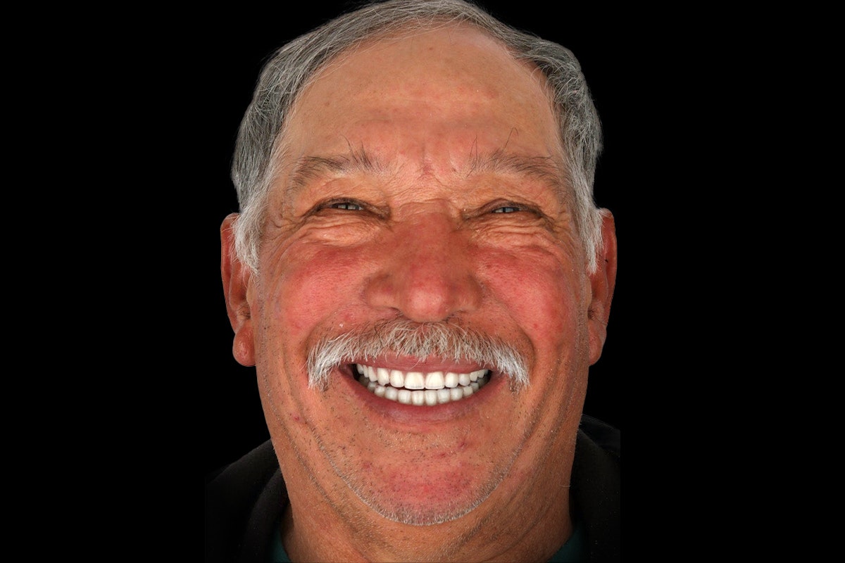 the same man with a bright and complete smile