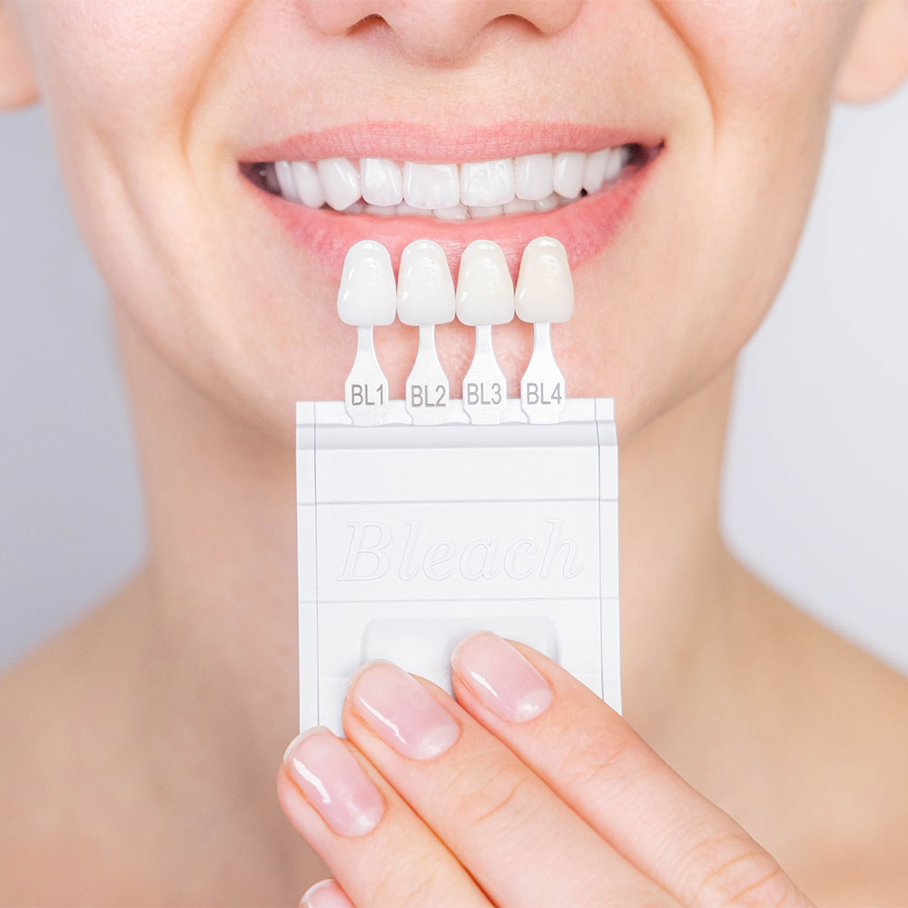 Smile Makeover Los Algodones, MX Tijuana, Mexico Marietta Dental Care