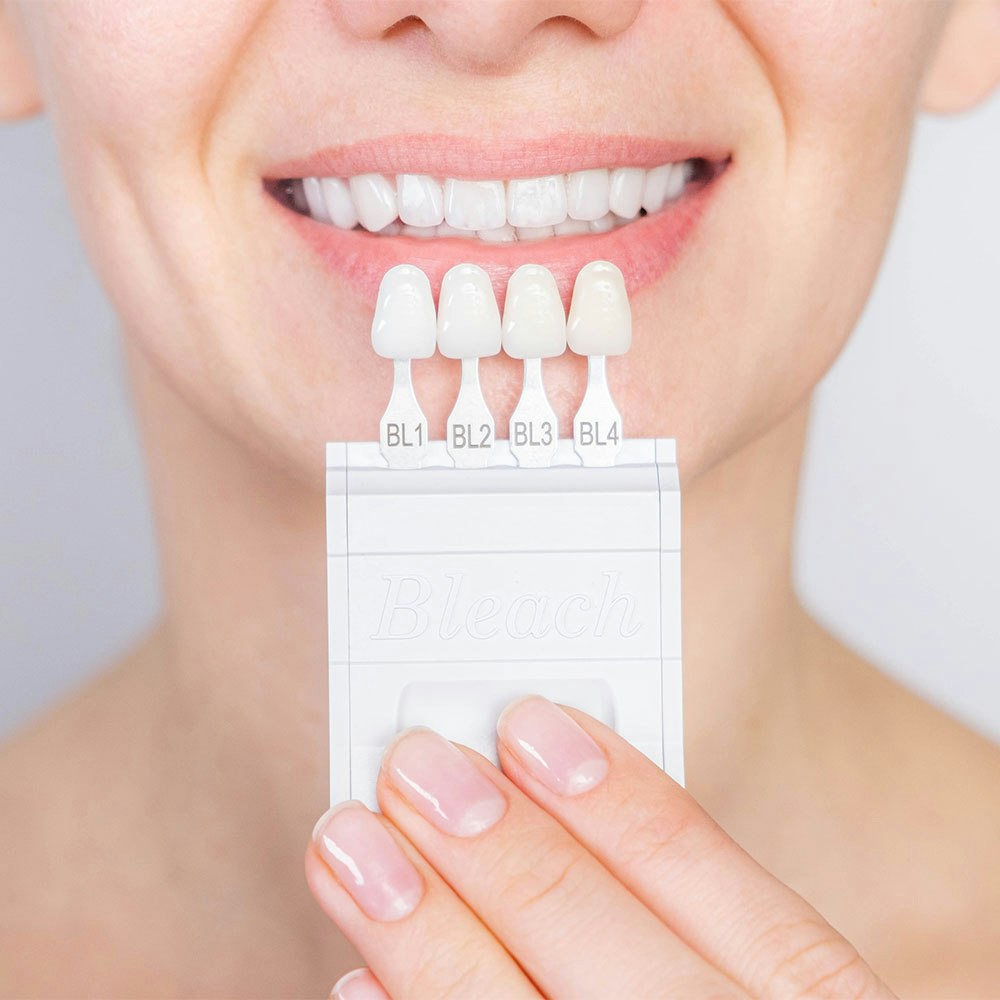Close-up of person holding a shade matcher next to their teeth