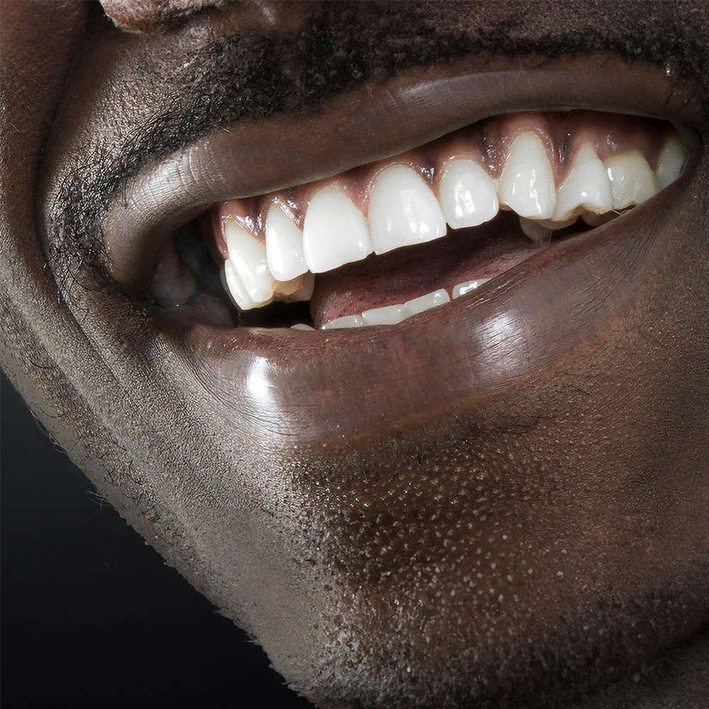 Close-up of man's gums