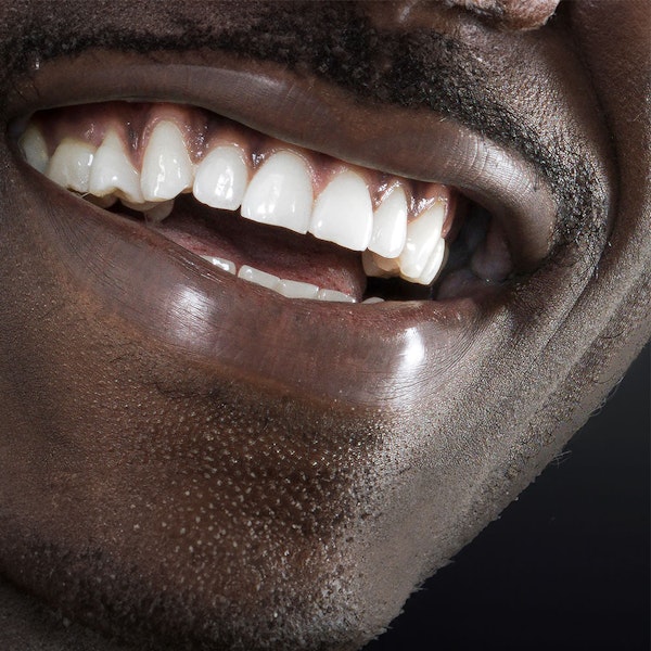 Close-up of man's gums