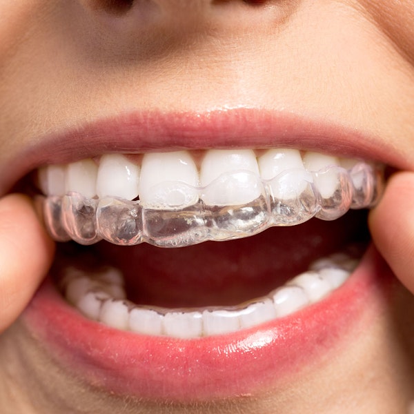Close-up of person placing Invisalign
