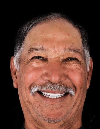 Implant patient after treatment