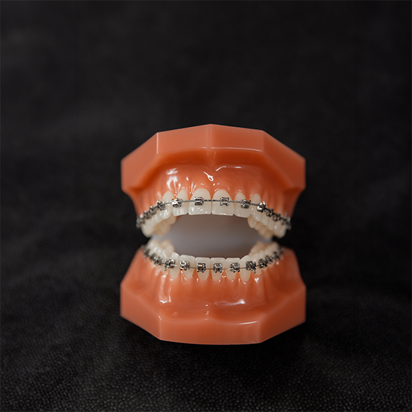 Braces on a dental model