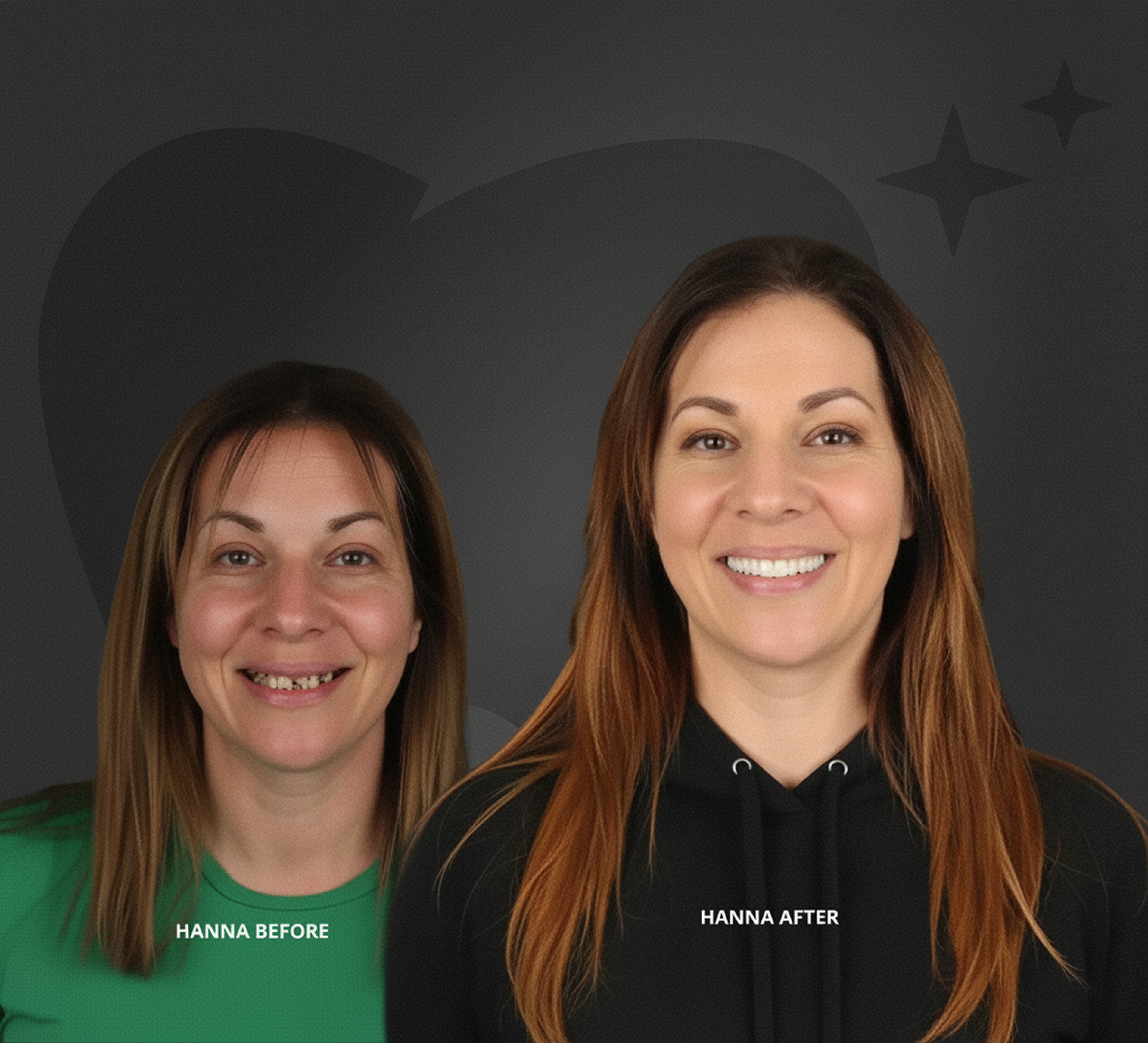 before and after implants