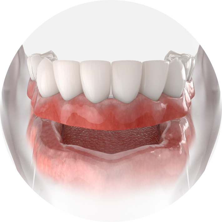 3D rendering of dentures