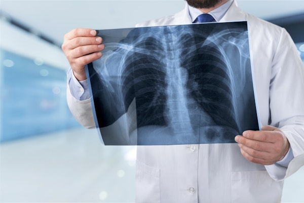 Doctor holding a chest X-ray up to examine it
