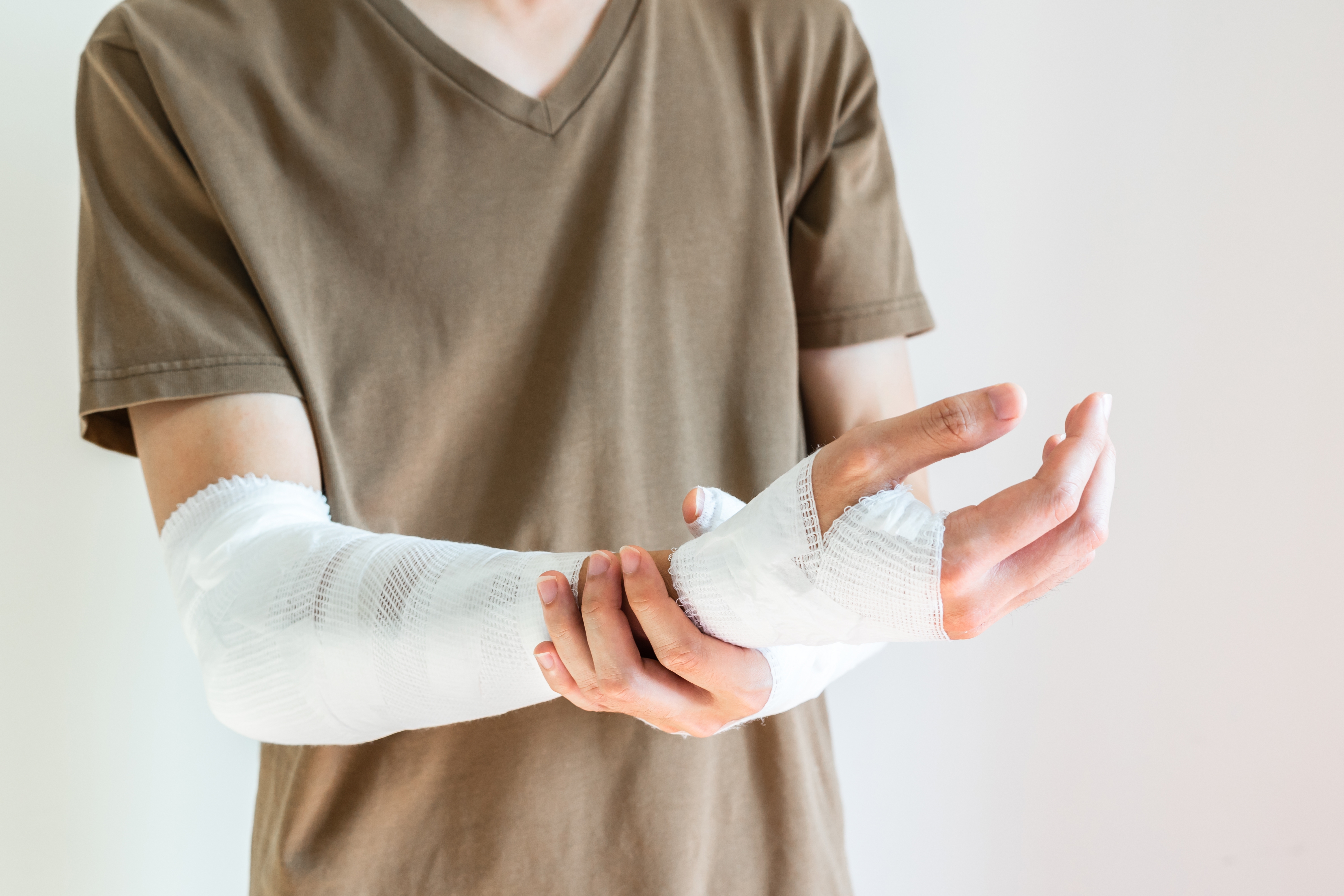 Person cradling a bandaged and casted forearm