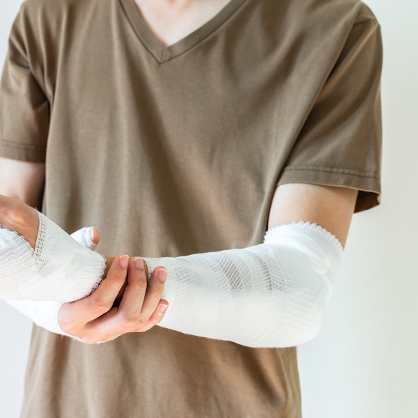 Person cradling a bandaged and casted forearm