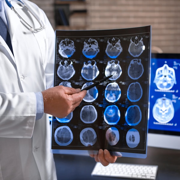 Doctor reviewing brain CT scans next to a monitor displaying additional neurological imaging