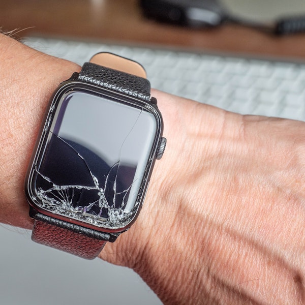 close-up of a wrist wearing a broken watch
