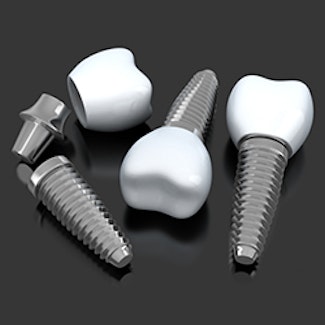 three illustrated implant