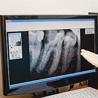 digital x-ray on computer