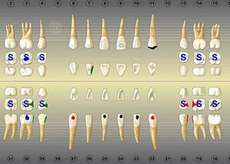 hand pointing to x-ray