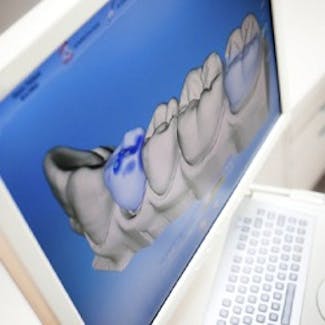 A monitor displaying a digitally captured section of teeth.