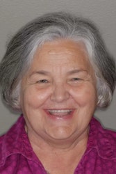 Full Mouth Rehabilitation Great Smile