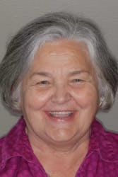 Full Mouth Rehabilitation Great Smile