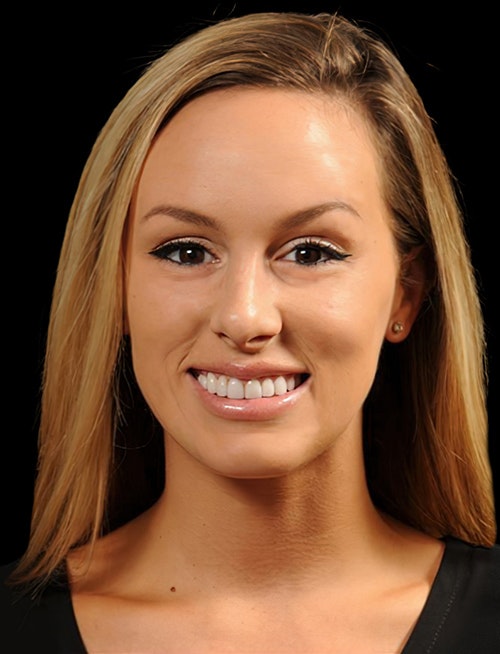 AFTER COSMETIC DENTISTRY