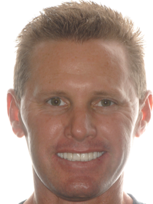 Dr. Ace Jovanovski's patient after crowns