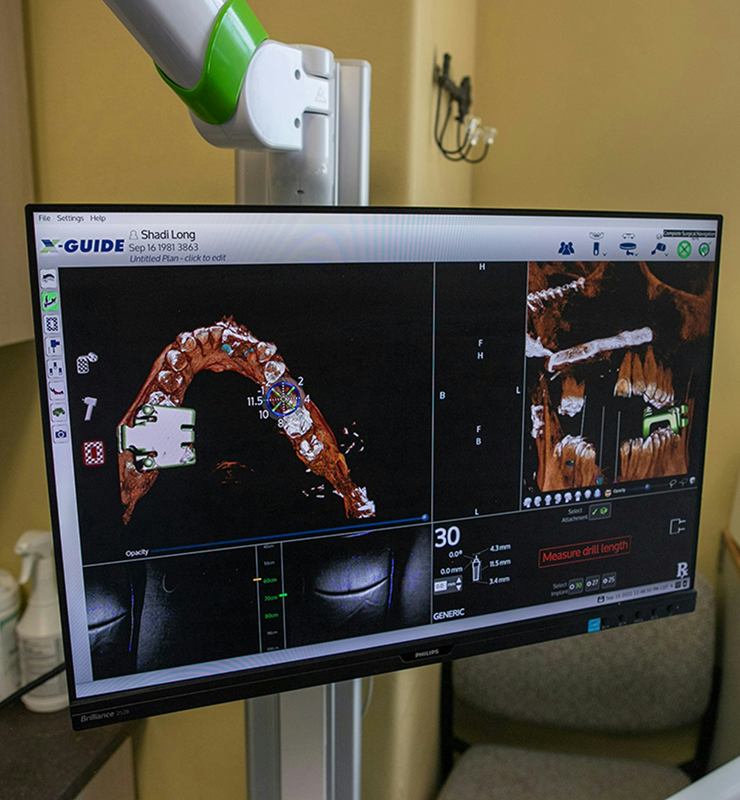 dental xray images on a computer at Jovan Prosthodontics