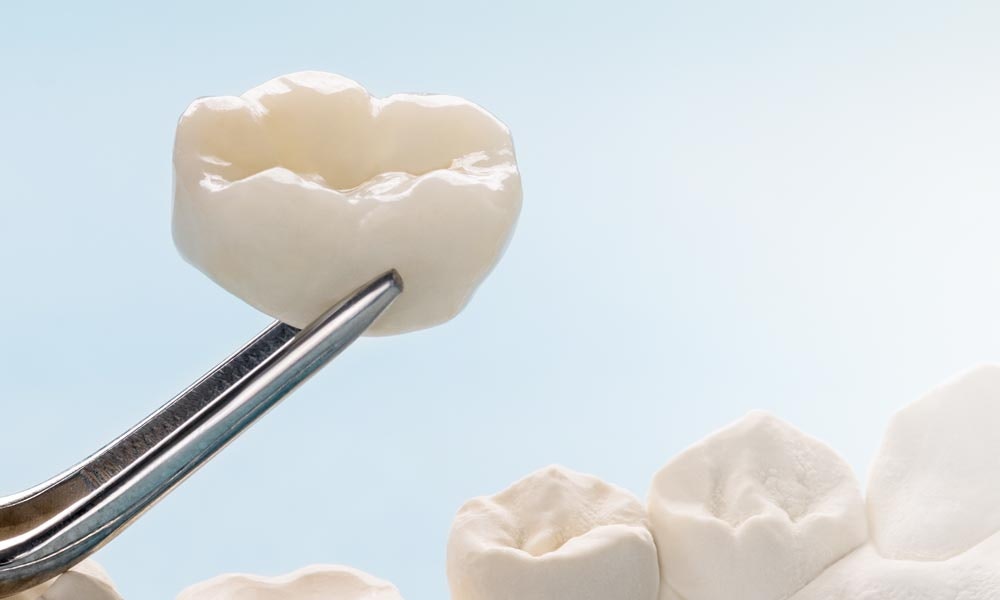 Dental Crown in Forceps