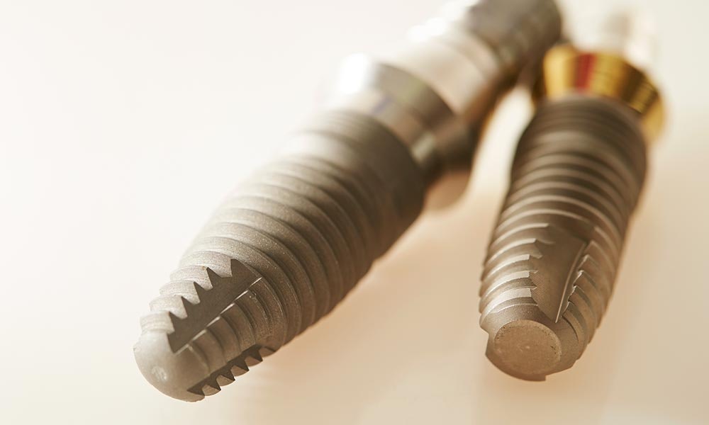 Dental Implants