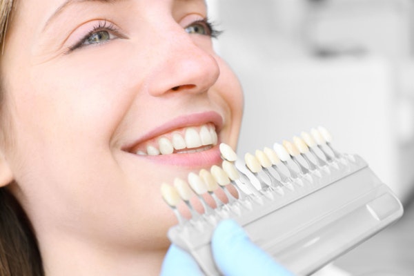 patient choosing a shade